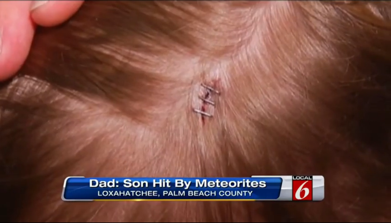 Did Falling Meteorites Injure 7-Year-Old Florida Boy?